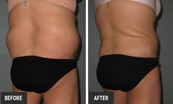 fattransfer