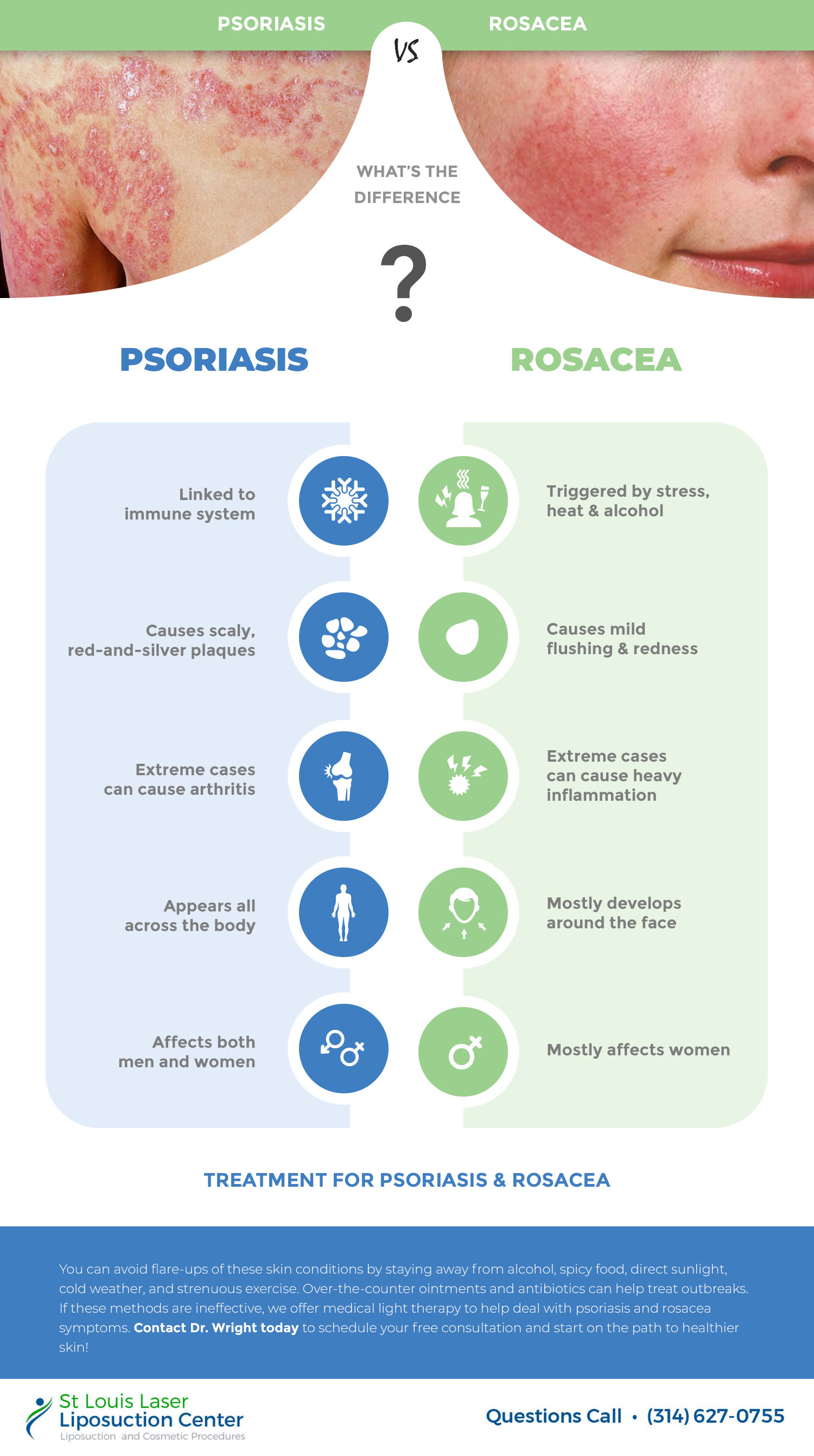 infographic about the symptoms of psoriasis and roascea