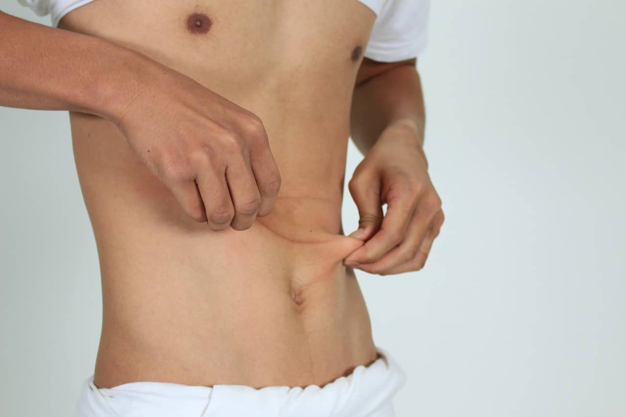post liposuction