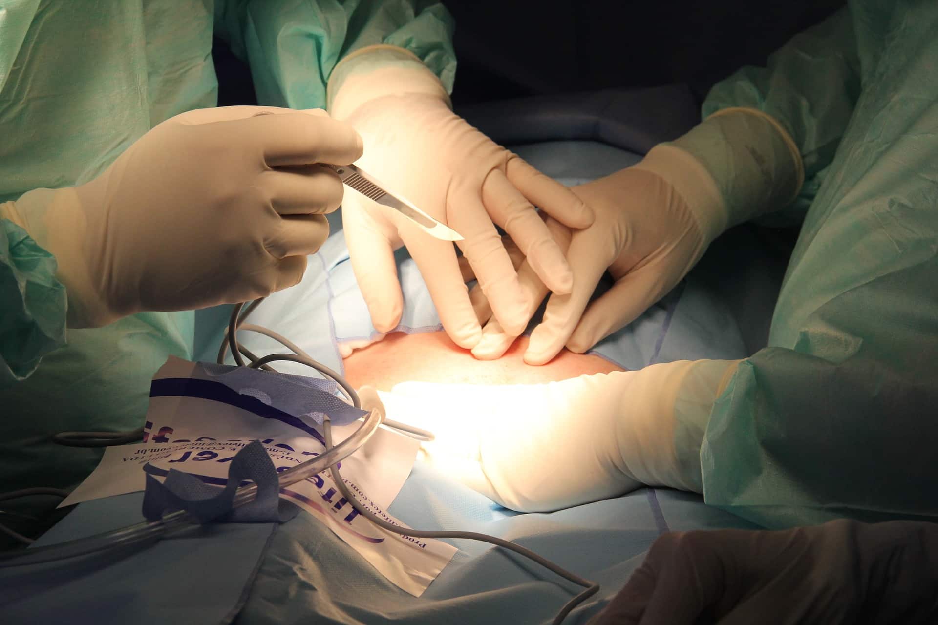 Procedures to Avoid