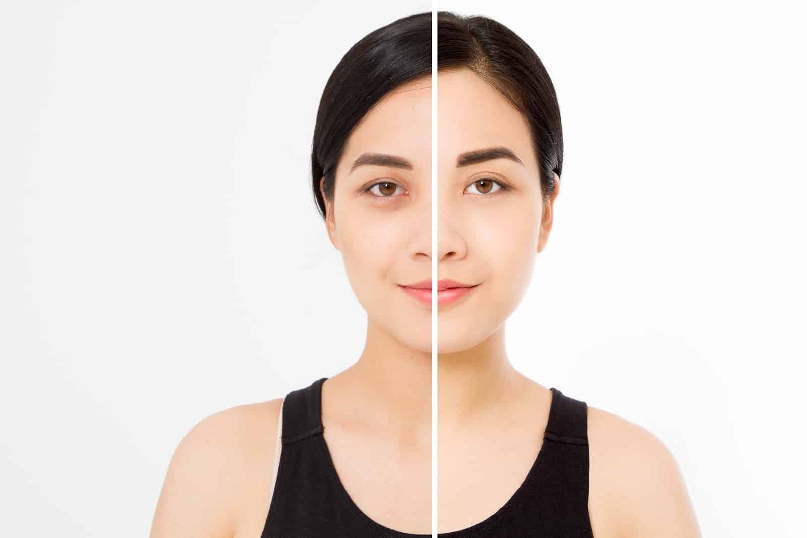 Before and After photo of a woman