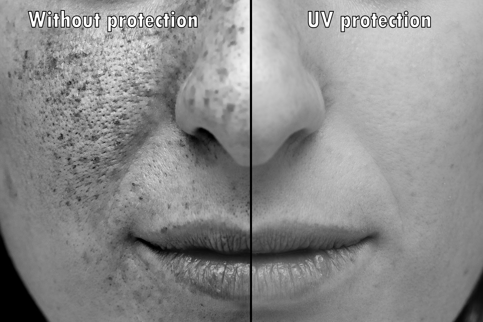 UV protection aging spots st louis