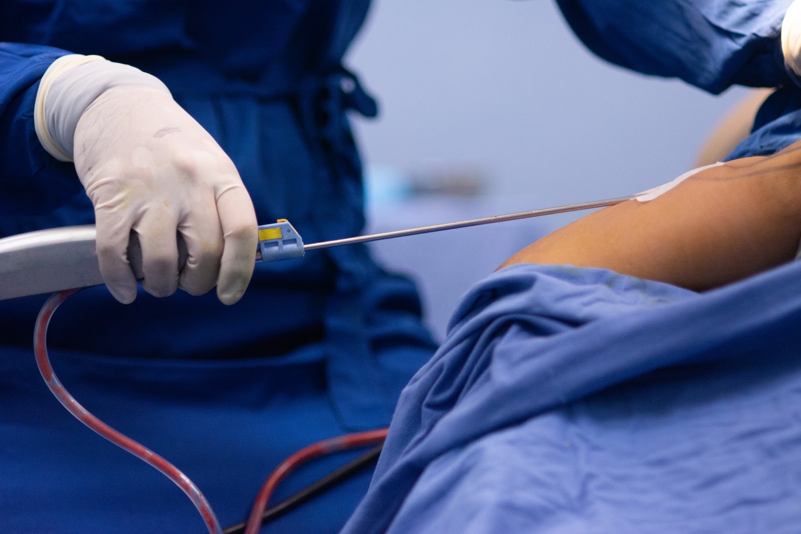 surgical liposuction tummy tuck