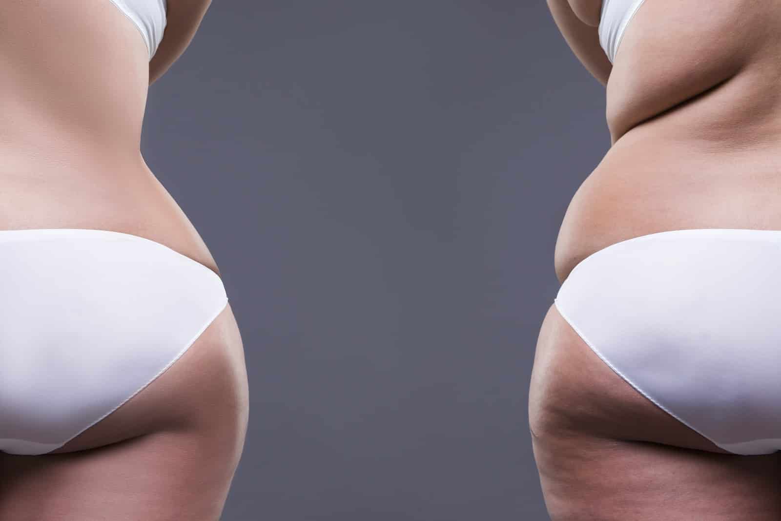 Overweight woman with fat legs and buttocks, before after concept, obesity female body on gray background, rear view