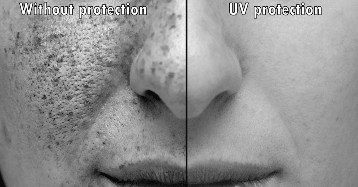 sun damage