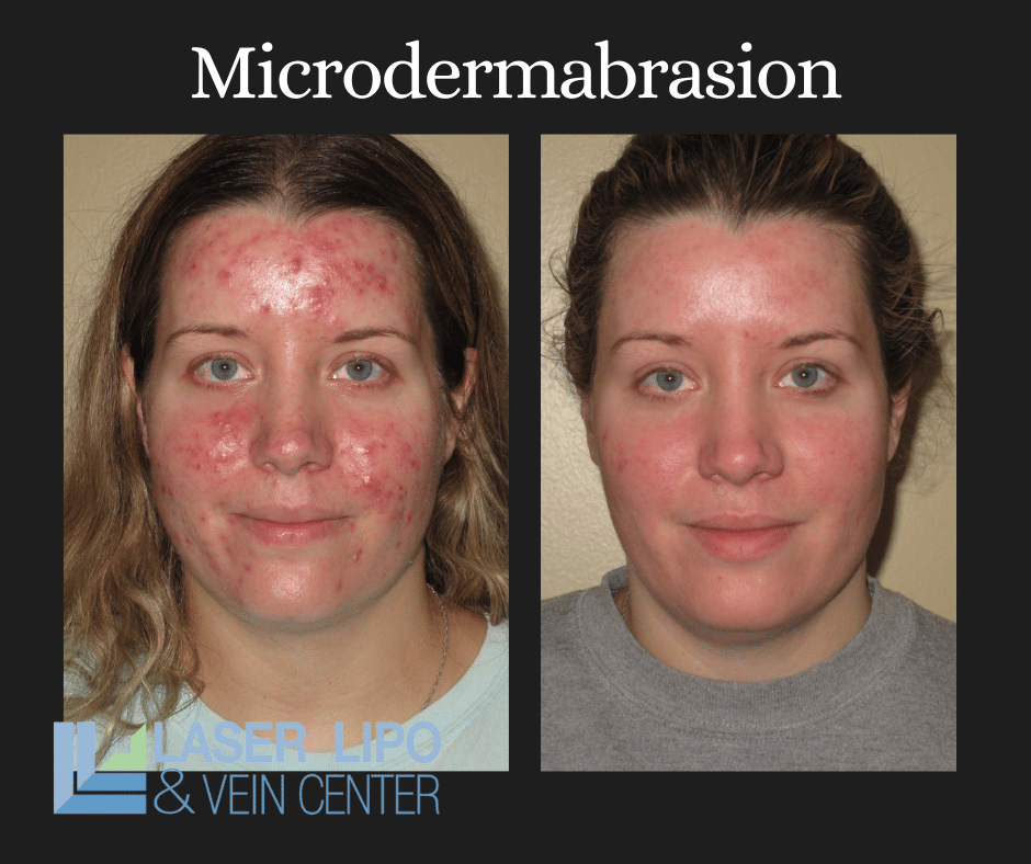Before & Afters (3)