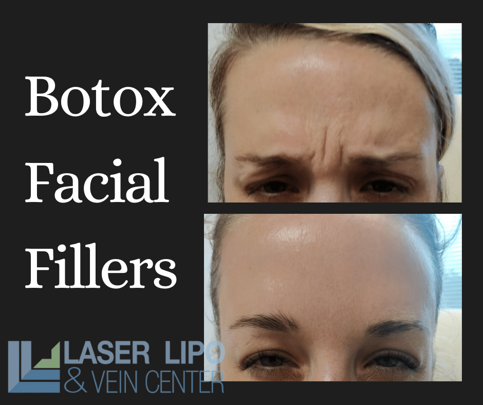 Before and Afters SLL