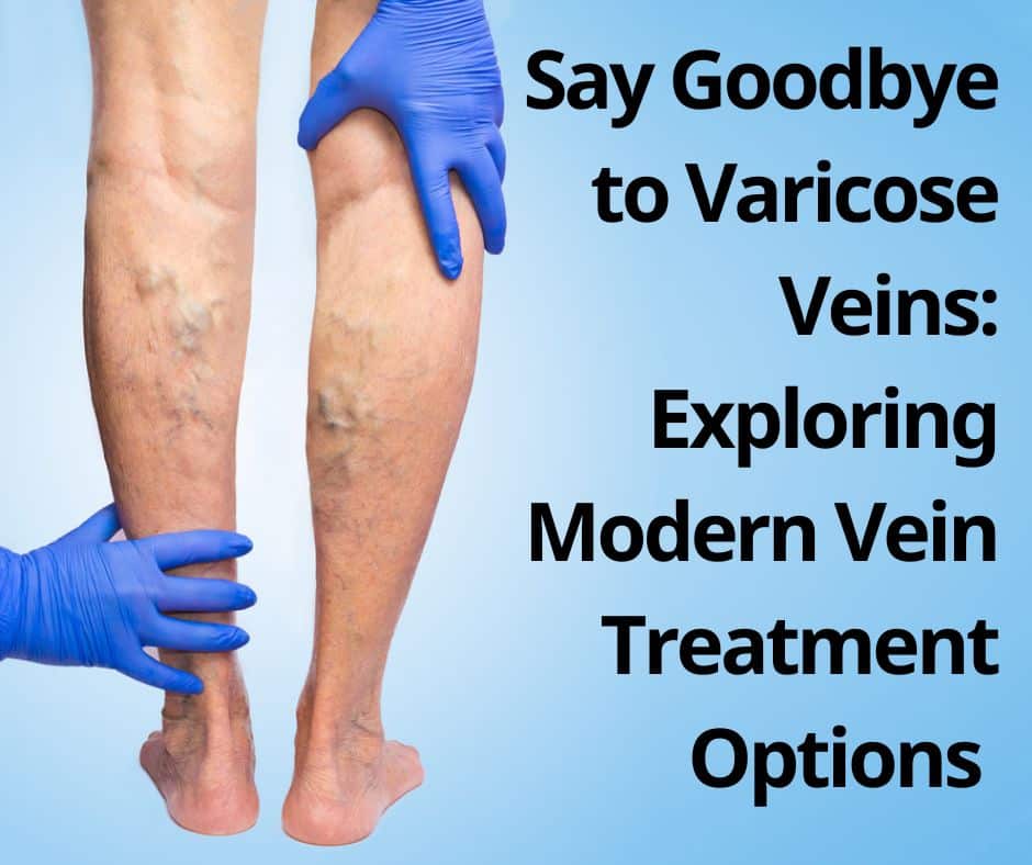 Say Goodbye to Varicose Veins Exploring Modern Vein Treatment Options St Louis