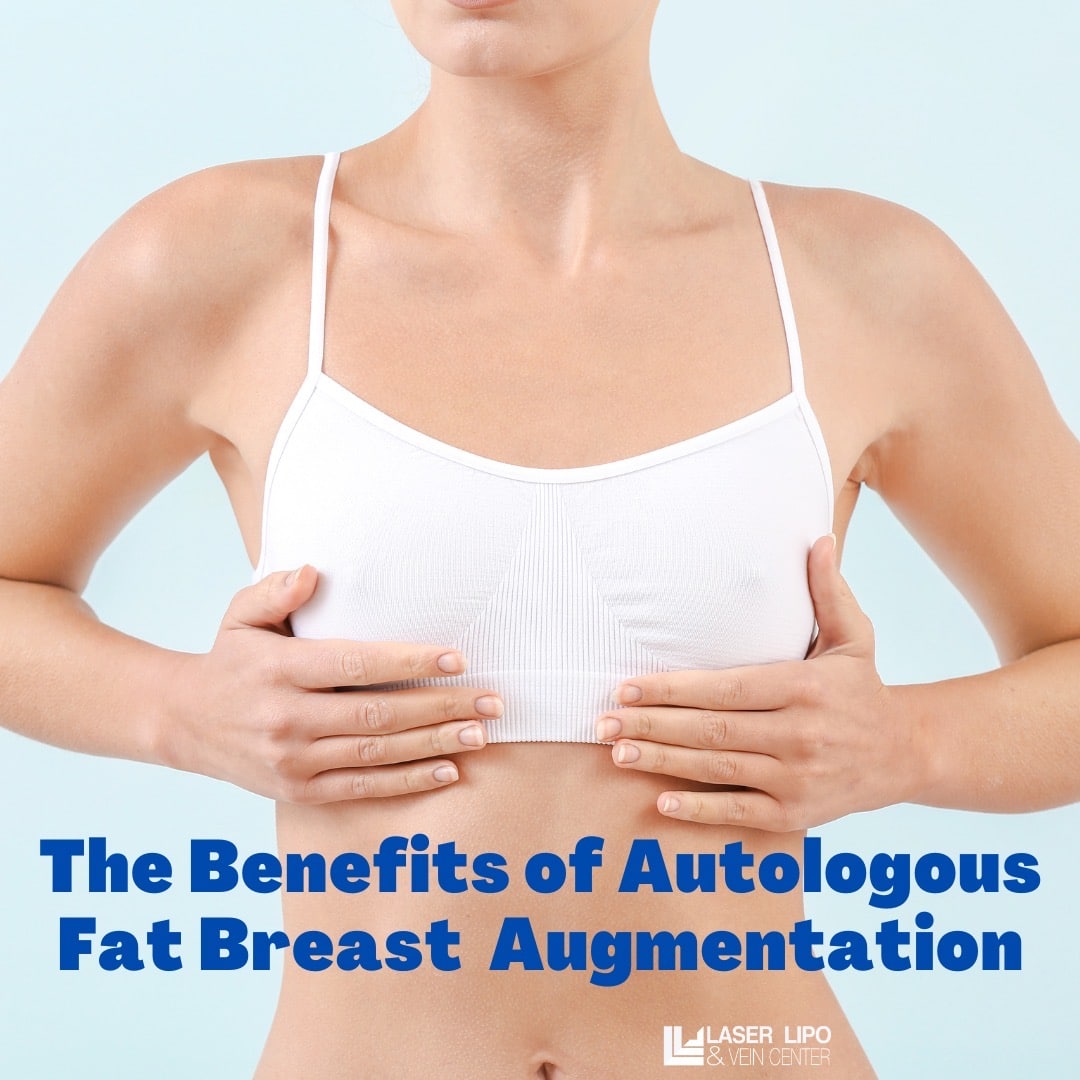 breast augmentation