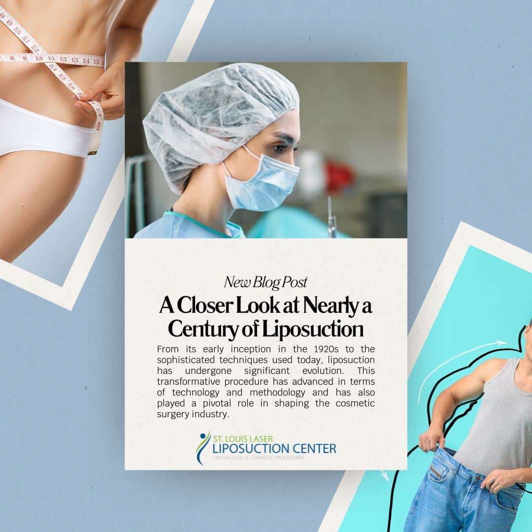 liposuction
