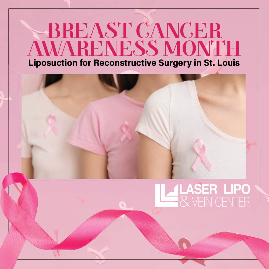 Breast Cancer Awareness Month