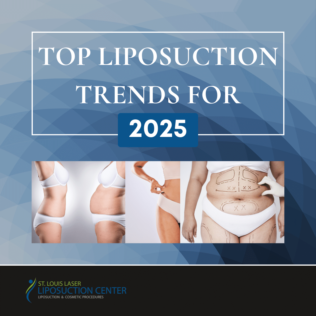 Top Liposuction Trends for 2025 What's New