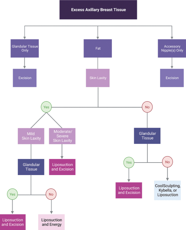 Flow Chart for Breast Tissue Excess