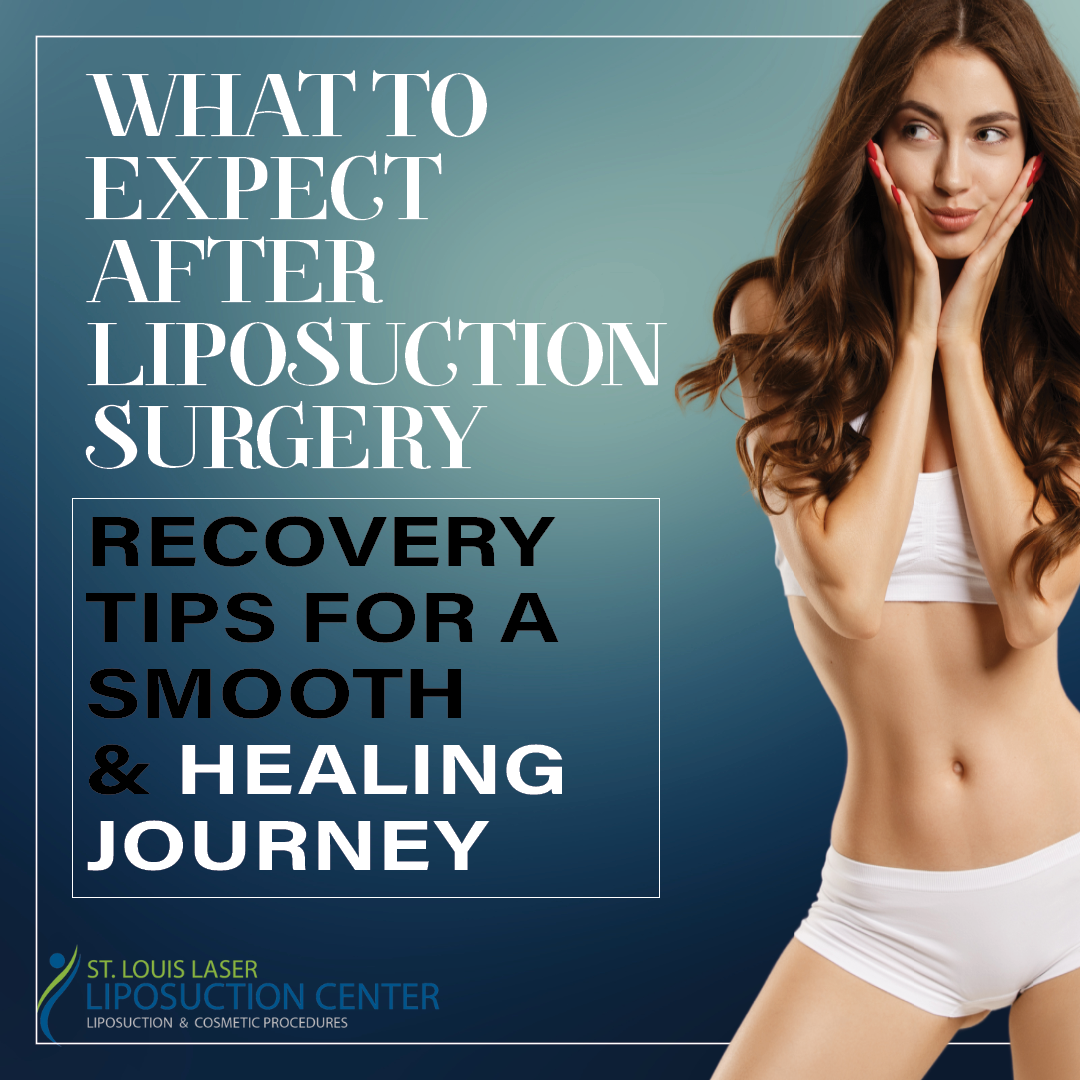 Dr Wright St Louis Lipo What to Expect After Liposuction Surgery