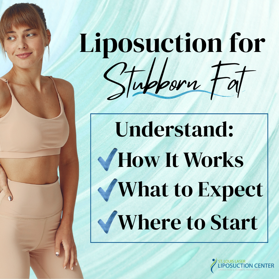Liposuction for Stubborn Fat St. Louis Lipo Dr. Wright