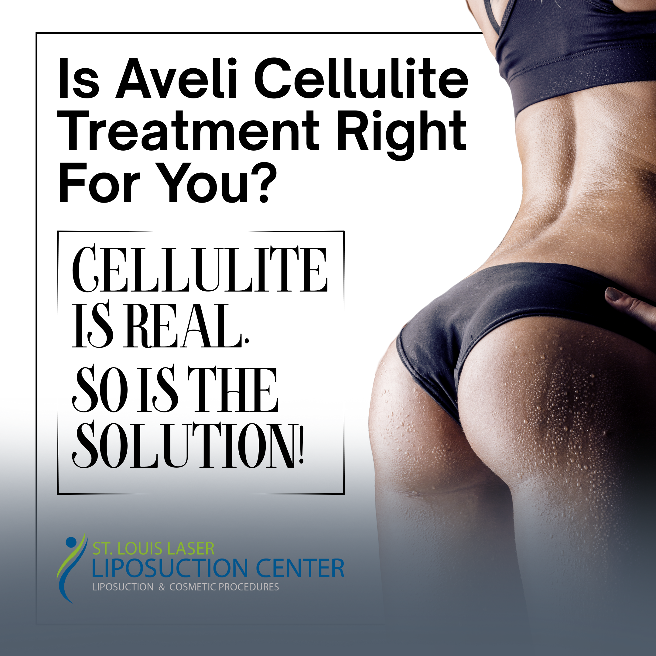Is Aveli Cellulite Treatment Right For You (1)